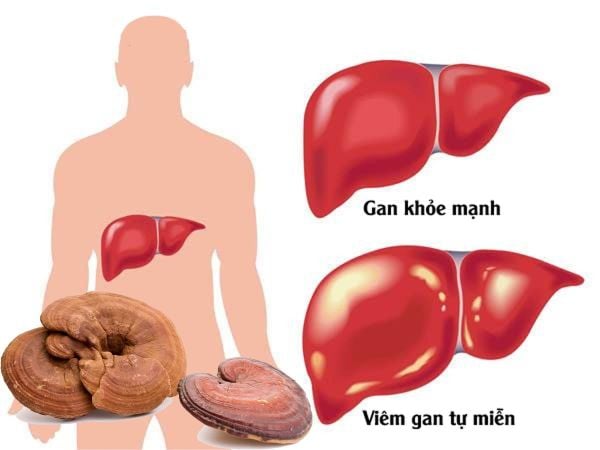 3. Bảo vệ gan và tăng cường chức năng giải độc