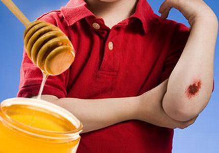 2. Kháng khuẩn, kháng viêm và hỗ trợ chữa lành vết thương